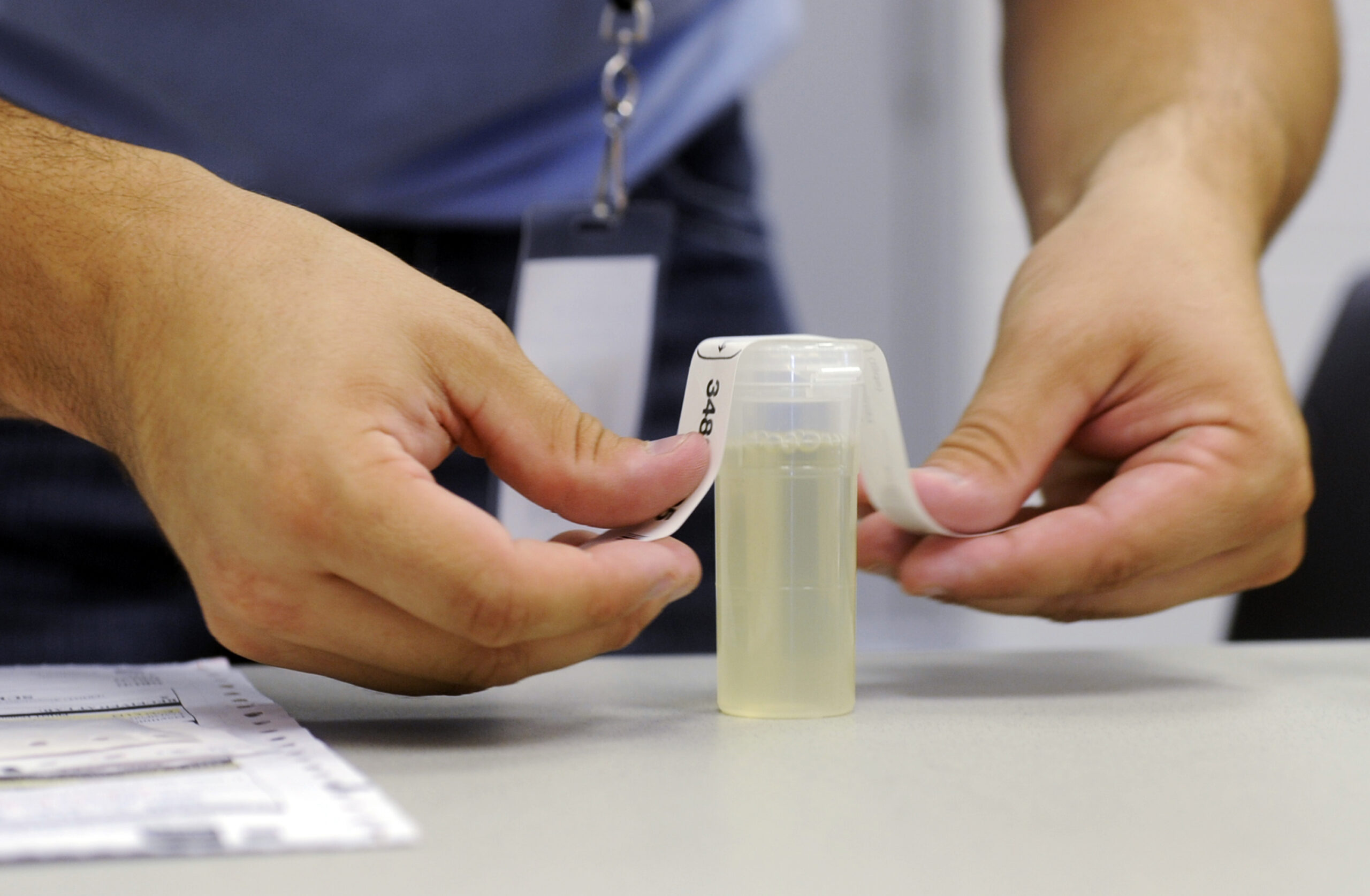 Employee labeling a urine specimen vile