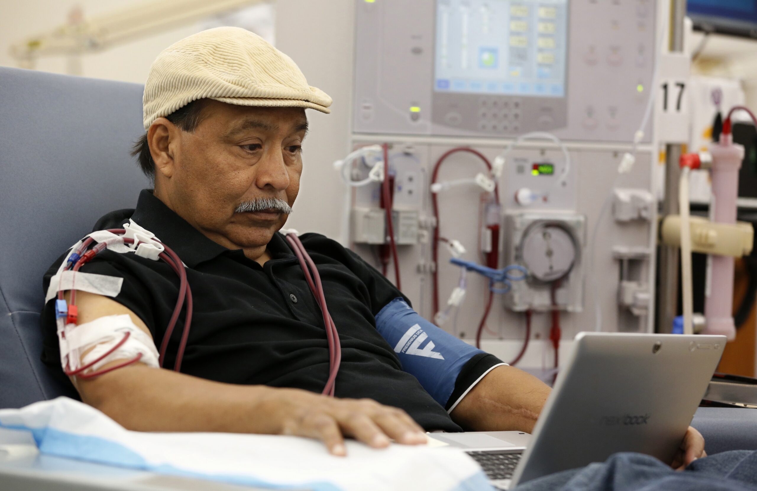 Study: More frequent extreme heat is a threat to dialysis patients