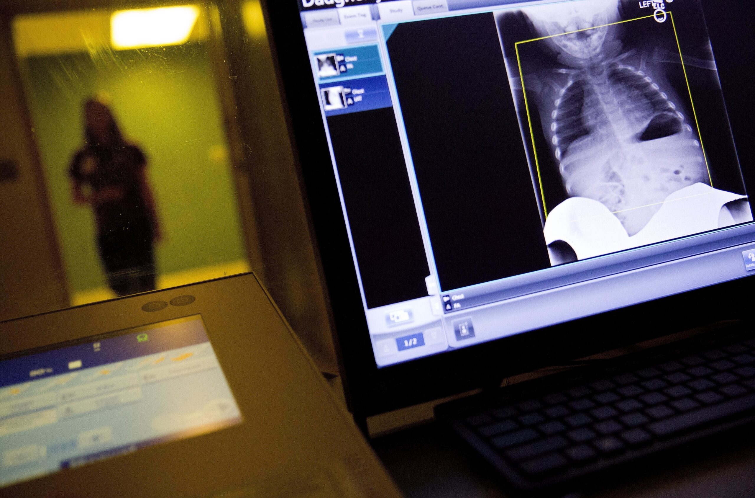 A radiology technician looks at a chest X-ray of a child.