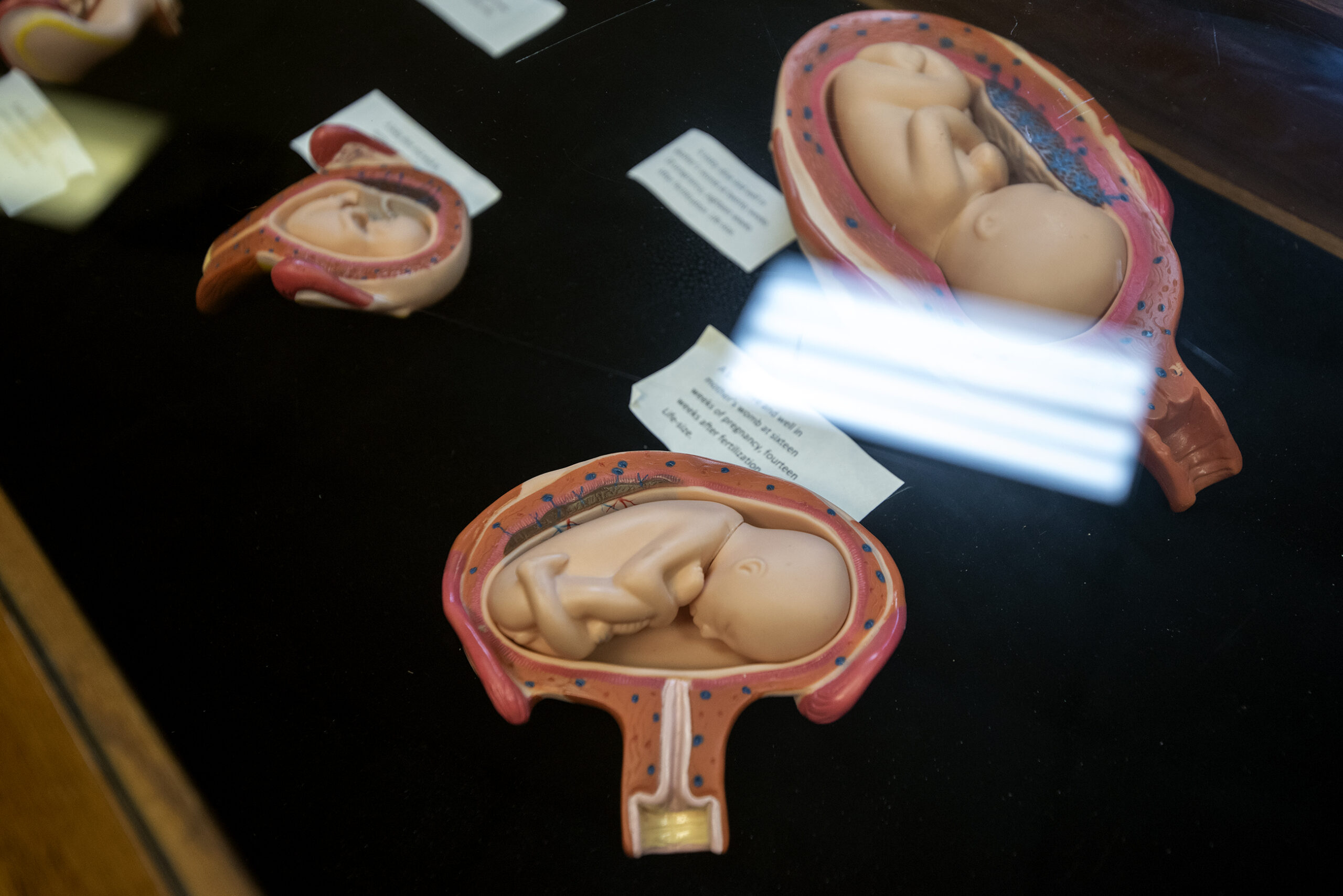 Figurines of a fetus at various stages of development are shown under a piece of glass.