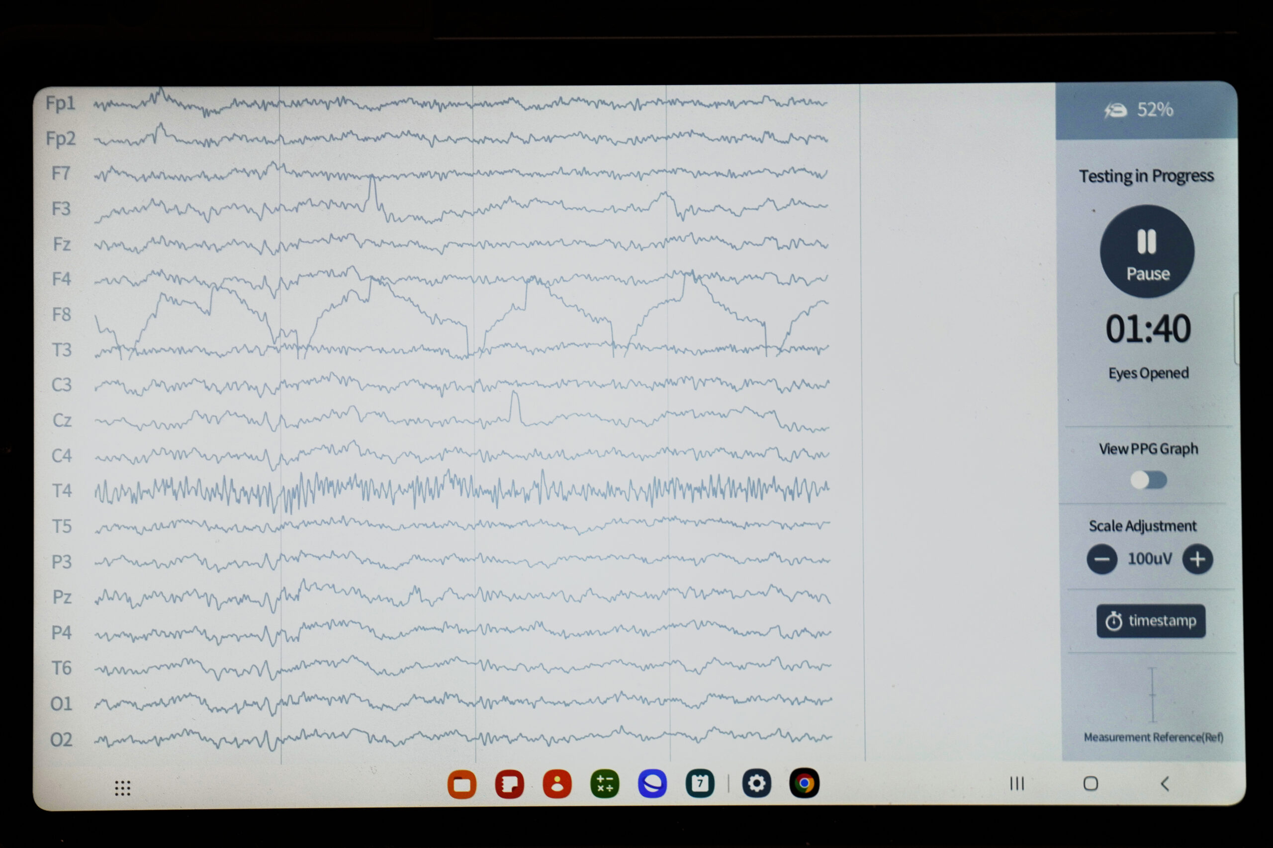 A brain wave is shown at the iMediSync booth.