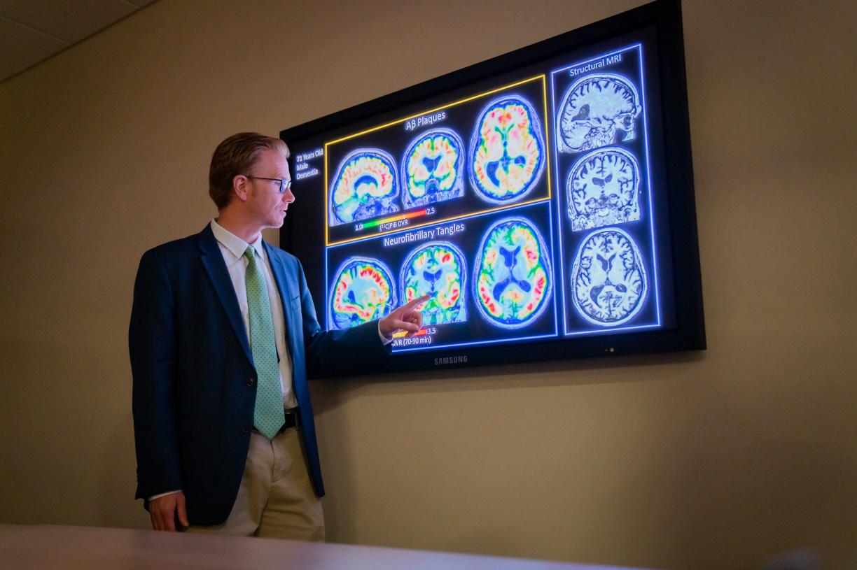 Wisconsin researchers begin data collection for national Alzheimer’s study